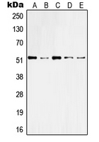 KRT10 / CK10 / Cytokeratin 10 Antibody - Western blot analysis of Cytokeratin 10 expression in HeLa (A); A431 (B); Raw264.7 (C); NIH3T3 (D); rat brain (E) whole cell lysates.