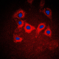 KRT10 / CK10 / Cytokeratin 10 Antibody - Immunofluorescent analysis of Cytokeratin 10 staining in A431 cells. Formalin-fixed cells were permeabilized with 0.1% Triton X-100 in TBS for 5-10 minutes and blocked with 3% BSA-PBS for 30 minutes at room temperature. Cells were probed with the primary antibody in 3% BSA-PBS and incubated overnight at 4 C in a humidified chamber. Cells were washed with PBST and incubated with a DyLight 594-conjugated secondary antibody (red) in PBS at room temperature in the dark. DAPI was used to stain the cell nuclei (blue).