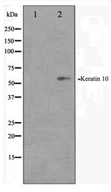 KRT10 / CK10 / Cytokeratin 10 Antibody - Western blot of HeLa cell lysate using Keratin 10 Antibody