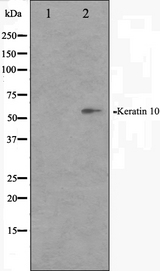 KRT10 / CK10 / Cytokeratin 10 Antibody - Western blot analysis on HeLa cell lysates using Keratin 10 antibody. The lane on the left is treated with the antigen-specific peptide.