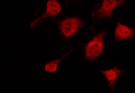 KRT10 / CK10 / Cytokeratin 10 Antibody - Staining HeLa cells by IF/ICC. The samples were fixed with PFA and permeabilized in 0.1% Triton X-100, then blocked in 10% serum for 45 min at 25°C. The primary antibody was diluted at 1:200 and incubated with the sample for 1 hour at 37°C. An Alexa Fluor 594 conjugated goat anti-rabbit IgG (H+L) Ab, diluted at 1/600, was used as the secondary antibody.