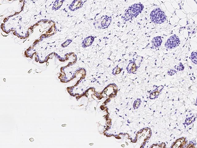 KRT10 / CK10 / Cytokeratin 10 Antibody - Immunochemical staining KRT10 in mouse skin with rabbit polyclonal antibody at 1:300 dilution, formalin-fixed paraffin embedded sections.