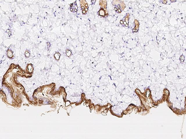 KRT10 / CK10 / Cytokeratin 10 Antibody - Immunochemical staining KRT10 in rat skin with rabbit polyclonal antibody at 1:300 dilution, formalin-fixed paraffin embedded sections.