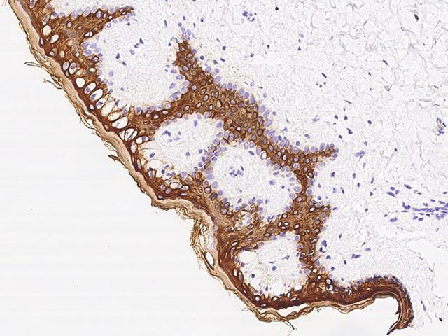 KRT10 / CK10 / Cytokeratin 10 Antibody - Immunochemical staining KRT10 in skin with rabbit polyclonal antibody at 1:300 dilution, formalin-fixed paraffin embedded sections.
