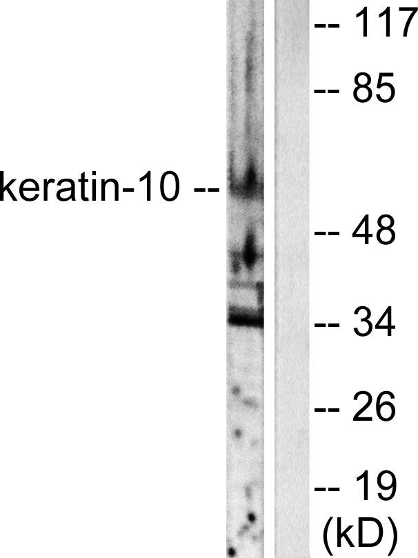 KRT10 / CK10 / Cytokeratin 10 Antibody - Western blot analysis of extracts from HeLa cells, using Keratin 10 antibody.