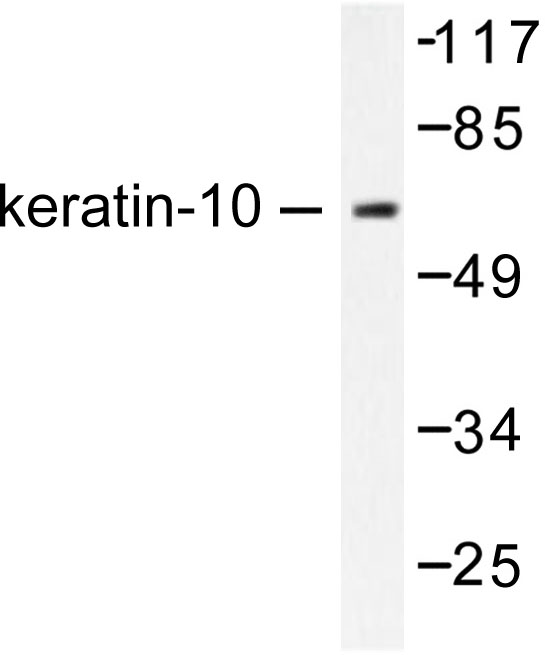 KRT10 / CK10 / Cytokeratin 10 Antibody - Western blot of Cytokeratin 10 (Y160) pAb in extracts from HeLa cells.