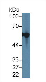 KRT12 / CK12 / Cytokeratin 12 Antibody