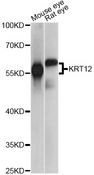 KRT12 / CK12 / Cytokeratin 12 Antibody - Western blot analysis of extracts of various cell lines, using KRT12 antibody at 1:1000 dilution. The secondary antibody used was an HRP Goat Anti-Rabbit IgG (H+L) at 1:10000 dilution. Lysates were loaded 25ug per lane and 3% nonfat dry milk in TBST was used for blocking. An ECL Kit was used for detection and the exposure time was 1s.