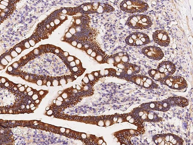 KRT12 / CK12 / Cytokeratin 12 Antibody - Immunochemical staining of human KRT12 in human duodenum with rabbit polyclonal antibody at 1:300 dilution, formalin-fixed paraffin embedded sections.