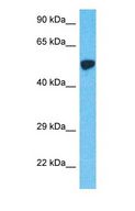 KRT12 / CK12 / Cytokeratin 12 Antibody - Western blot of KRT12 Antibody with human MCF7 Whole Cell lysate.  This image was taken for the unconjugated form of this product. Other forms have not been tested.