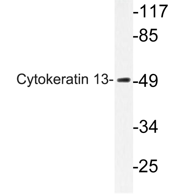 KRT13 / CK13 / Cytokeratin 13 Antibody - Western blot analysis of lysate from HepG2 cells, using Cytokeratin 13 antibody.