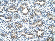 KRT13 / CK13 / Cytokeratin 13 Antibody - KRT13 / Cytokeratin 13 antibody ARP42031_T100-NP_002265-KRT13(keratin 13) Antibody was used in IHC to stain formalin-fixed, paraffin-embedded human lung.  This image was taken for the unconjugated form of this product. Other forms have not been tested.