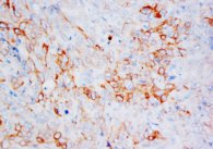 KRT13 / CK13 / Cytokeratin 13 Antibody -  This image was taken for the unconjugated form of this product. Other forms have not been tested.