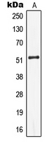 KRT13 / CK13 / Cytokeratin 13 Antibody - Western blot analysis of Cytokeratin 13 expression in Jurkat (A) whole cell lysates.