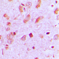 KRT13 / CK13 / Cytokeratin 13 Antibody - Immunohistochemical analysis of Cytokeratin 13 staining in human brain formalin fixed paraffin embedded tissue section. The section was pre-treated using heat mediated antigen retrieval with sodium citrate buffer (pH 6.0). The section was then incubated with the antibody at room temperature and detected using an HRP conjugated compact polymer system. DAB was used as the chromogen. The section was then counterstained with hematoxylin and mounted with DPX.