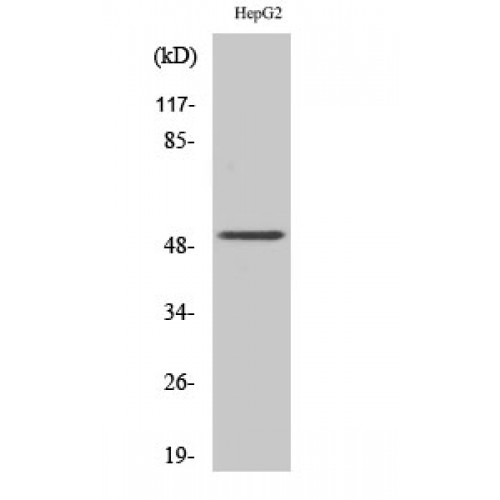 KRT13 / CK13 / Cytokeratin 13 Antibody - Western blot of Cytokeratin 13 antibody