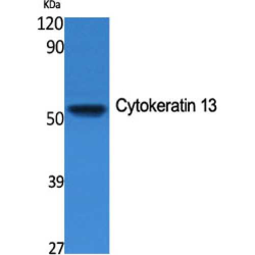 KRT13 / CK13 / Cytokeratin 13 Antibody - Western blot of Cytokeratin 13 antibody
