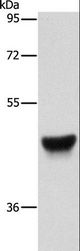 KRT13 / CK13 / Cytokeratin 13 Antibody - Western blot analysis of Human esophagus cancer tissue, using KRT13 Polyclonal Antibody at dilution of 1:500.