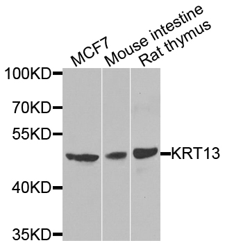KRT13 / CK13 / Cytokeratin 13 Antibody - Western blot analysis of extracts of various cell lines.