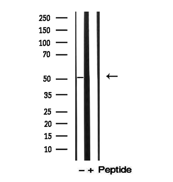 KRT13 / CK13 / Cytokeratin 13 Antibody - Western blot analysis of A431 whole cells lysates using Cytokeratin 13 antibody. The lane on the Right is treated with the antigen-specific peptide.
