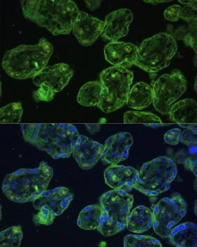 KRT13 / CK13 / Cytokeratin 13 Antibody - Immunofluorescence analysis of Human placenta using KRT13 Polyclonal Antibody at dilution of 1:100 (40x lens).Blue: DAPI for nuclear staining.