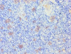 KRT14 / CK14 / Cytokeratin 14 Antibody - Immunohistochemistry of paraffin-embedded human tonsil using antibody at 1:100 dilution.  This image was taken for the unconjugated form of this product. Other forms have not been tested.