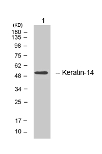 KRT14 / CK14 / Cytokeratin 14 Antibody - Western blot analysis of lysates from HepG2 cells, using Keratin 14 Antibody.