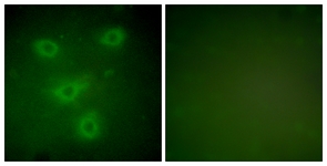 KRT14 / CK14 / Cytokeratin 14 Antibody - Immunofluorescence analysis of NIH-3T3 cells, using Keratin 14 Antibody. The picture on the right is treated with the synthesized peptide.
