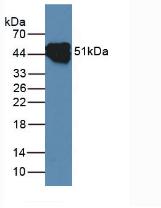 KRT14 / CK14 / Cytokeratin 14 Antibody - Western Blot; Sample: Rat Skin Tissue.