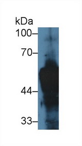 KRT14 / CK14 / Cytokeratin 14 Antibody - Western Blot; Sample: Rat Skin lysate; Primary Ab: 5µg/ml Rabbit Anti-Rat KRT14 Antibody Second Ab: 0.2µg/mL HRP-Linked Caprine Anti-Rabbit IgG Polyclonal Antibody