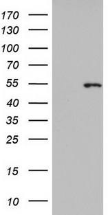KRT14 / CK14 / Cytokeratin 14 Antibody - HEK293T cells were transfected with the pCMV6-ENTRY control (Left lane) or pCMV6-ENTRY KRT14 (Right lane) cDNA for 48 hrs and lysed. Equivalent amounts of cell lysates (5 ug per lane) were separated by SDS-PAGE and immunoblotted with anti-KRT14.