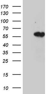 KRT14 / CK14 / Cytokeratin 14 Antibody - HEK293T cells were transfected with the pCMV6-ENTRY control. (Left lane) or pCMV6-ENTRY KRT14. (Right lane) cDNA for 48 hrs and lysed. Equivalent amounts of cell lysates. (5 ug per lane) were separated by SDS-PAGE and immunoblotted with anti-KRT14. (1:500)
