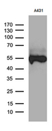 KRT14 / CK14 / Cytokeratin 14 Antibody - Western blot analysis of extracts. (35ug) from A431 cell line by using anti-KRT14 monoclonal antibody. (1:500)