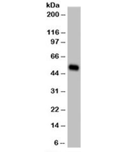 KRT14 / CK14 / Cytokeratin 14 Antibody - Western blot testing of A431 cell lysate (epidermoid carcinoma) and Cytokeratin 14 antibody (clone LL002) at 1ug/ml. Predicted/observed molecular weight: ~53kDa. This image was taken for the unmodified form of this product. Other forms have not been tested.