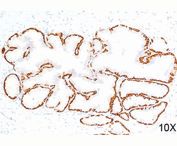 KRT14 / CK14 / Cytokeratin 14 Antibody - Cytokeratin 14 antibody LL002 immunohistochemistry prostate 10X.  This image was taken for the unmodified form of this product. Other forms have not been tested.