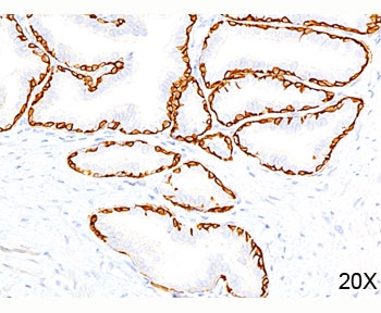 KRT14 / CK14 / Cytokeratin 14 Antibody - Cytokeratin 14 antibody LL002 immunohistochemistry prostate 20X.  This image was taken for the unmodified form of this product. Other forms have not been tested.