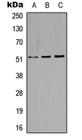 KRT14 / CK14 / Cytokeratin 14 Antibody - Western blot analysis of Cytokeratin 14 expression in A549 (A); Raw264.7 (B); H9C2 (C) whole cell lysates.