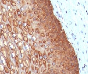 KRT14 / CK14 / Cytokeratin 14 Antibody - IHC testing of FFPE human cervix with Keratin 14 antibody (clone CTKN14-1).  This image was taken for the unmodified form of this product. Other forms have not been tested.