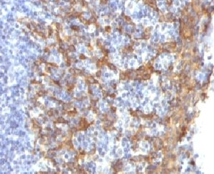 KRT14 / CK14 / Cytokeratin 14 Antibody - IHC testing of FFPE human prostate with Keratin 14 antibody.