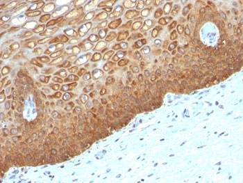 KRT14 / CK14 / Cytokeratin 14 Antibody - Formalin-fixed, paraffin-embedded human cervix stained with Keratin 14 antibody (KRT14/532).  This image was taken for the unmodified form of this product. Other forms have not been tested.