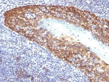 KRT14 / CK14 / Cytokeratin 14 Antibody - Formalin-fixed, paraffin-embedded human tonsil stained with Keratin 14 antibody (KRT14/532).  This image was taken for the unmodified form of this product. Other forms have not been tested.