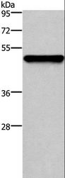 KRT14 / CK14 / Cytokeratin 14 Antibody - Western blot analysis of Mouse skin tissue, using KRT14 Polyclonal Antibody at dilution of 1:1000.