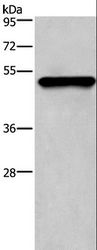 KRT14 / CK14 / Cytokeratin 14 Antibody - Western blot analysis of Mouse skin tissue, using KRT14 Polyclonal Antibody at dilution of 1:1350.