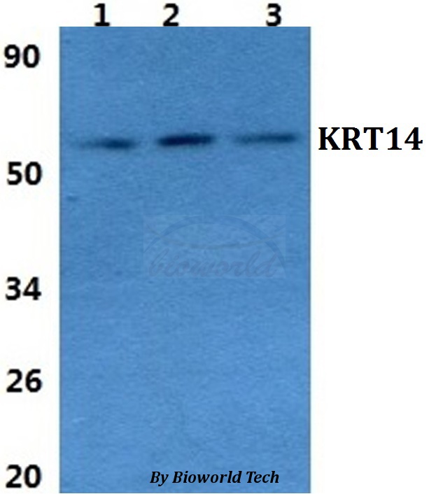 KRT14 / CK14 / Cytokeratin 14 Antibody - Western blot of Cytokeratin 14 antibody at 1:500 dilution. Lane 1: A549 whole cell lysate. Lane 2: H9C2 whole cell lysate. Lane 3: Raw264.7 whole cell lysate.