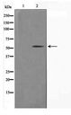 KRT14 / CK14 / Cytokeratin 14 Antibody - Western blot of NIH-3T3 cell lysate using Keratin 14 Antibody