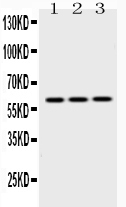 KRT14 / CK14 / Cytokeratin 14 Antibody - Western blot - Anti-Cytokeratin 14 Picoband Antibody
