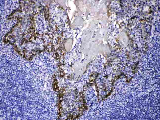 KRT14 / CK14 / Cytokeratin 14 Antibody - Cytokeratin 14 was detected in paraffin-embedded sections of human tonsil tissues using rabbit anti- Cytokeratin 14 Antigen Affinity purified polyclonal antibody