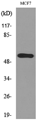 KRT14 / CK14 / Cytokeratin 14 Antibody - Western blot analysis of lysate from MCF7 cells, using KRT14 Antibody.