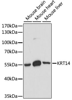 KRT14 / CK14 / Cytokeratin 14 Antibody - Western blot analysis of extracts of various cell lines, using KRT14 antibody at 1:1000 dilution. The secondary antibody used was an HRP Goat Anti-Rabbit IgG (H+L) at 1:10000 dilution. Lysates were loaded 25ug per lane and 3% nonfat dry milk in TBST was used for blocking. An ECL Kit was used for detection and the exposure time was 90s.