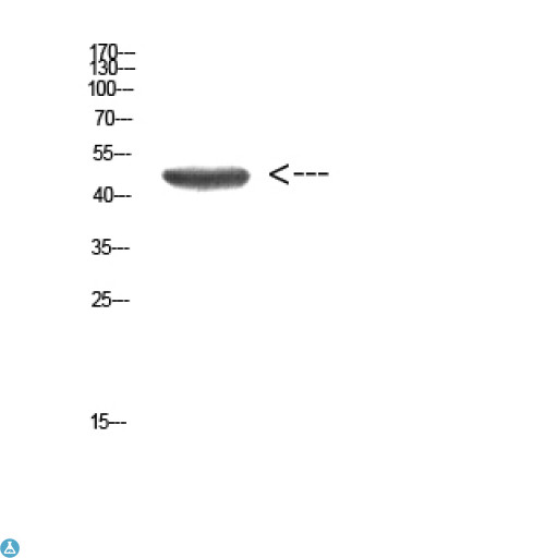 KRT14 / CK14 / Cytokeratin 14 Antibody - Immunohistochemical analysis of paraffin-embedded human-skin, antibody was diluted at 1:200.